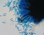 Spore de dartrose Spore de dartrose