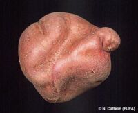 d&eacute;formation Physiologique