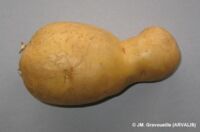 Plus de d&eacute;formation physiologiques