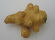 Physiological deformations Physiological deformations